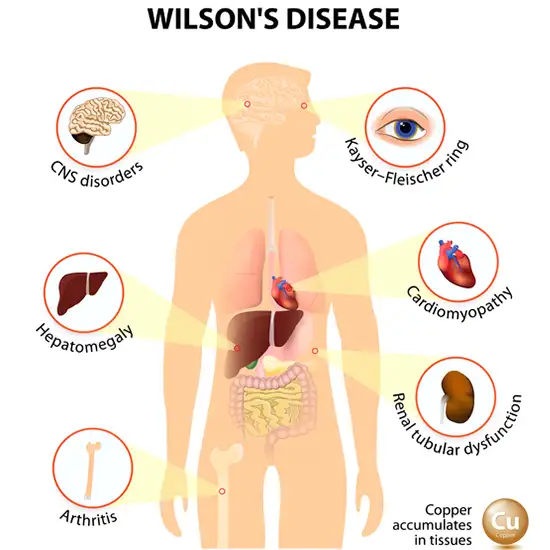Wilson Disease Panel